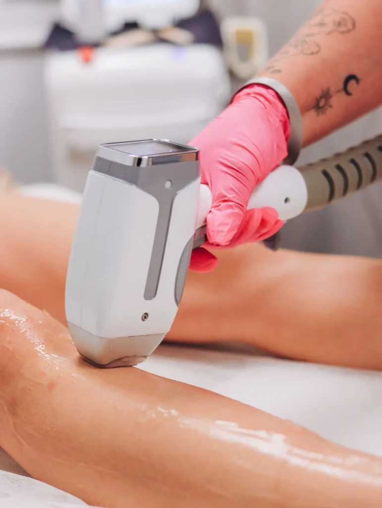 Laserontharing | Beautysalon skincare-23